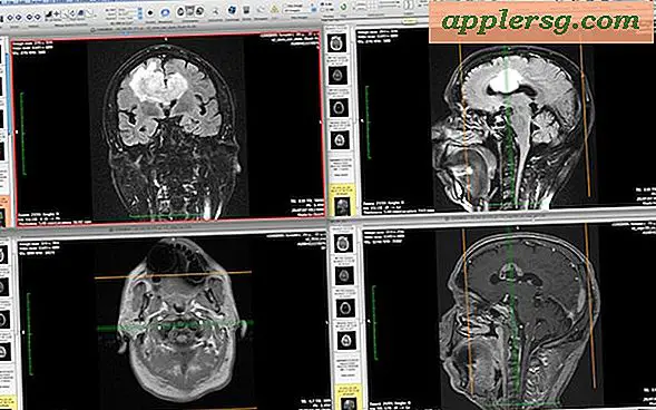 Öffnen, Anzeigen und Lesen von DICOM .DCM Medical Images in Mac OS X und iOS mit OsiriX